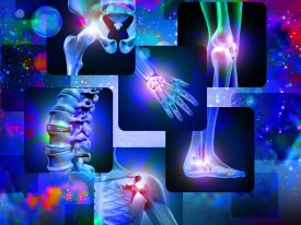Joint Pain Background